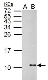 Anti-Influenza A virus NS2 / NEP antibody used in Western Blot (WB). GTX125953